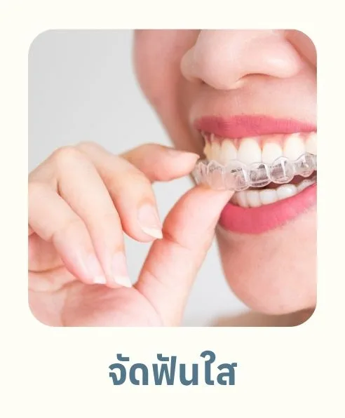 จัดฟันใส