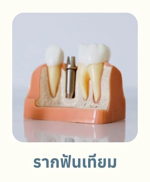 รากฟันเทียม