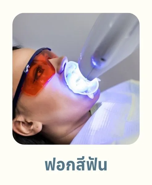 ฟอกสีฟัน