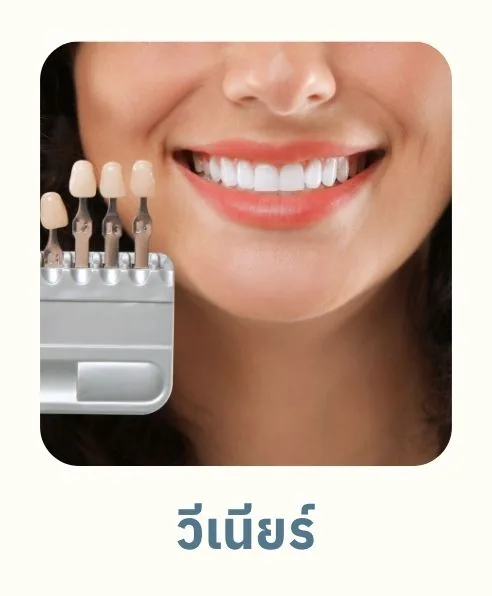วีเนียร์