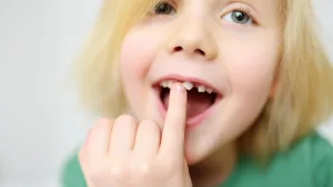 หลังรักษารากฟันน้ำนม ทำไมคุณหมอจึงแนะนำให้ครอบฟัน?