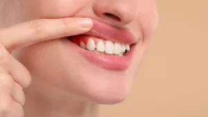 เกลารากฟันต่างจากขูดหินปูนอย่างไร?